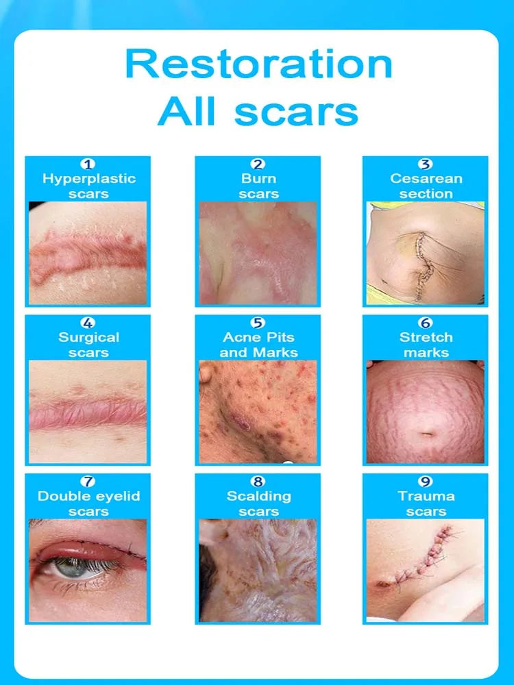 Wound scar laser products