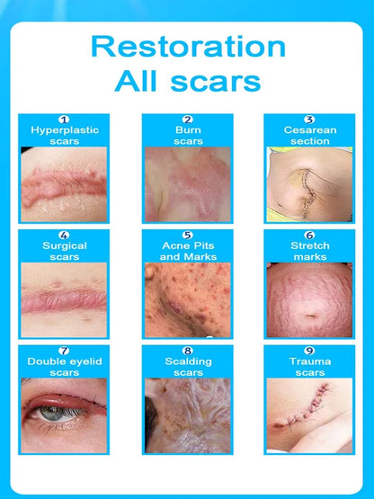 Wound scar laser products