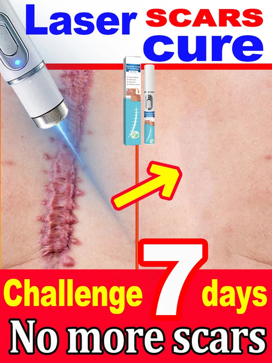 Wound scar laser products