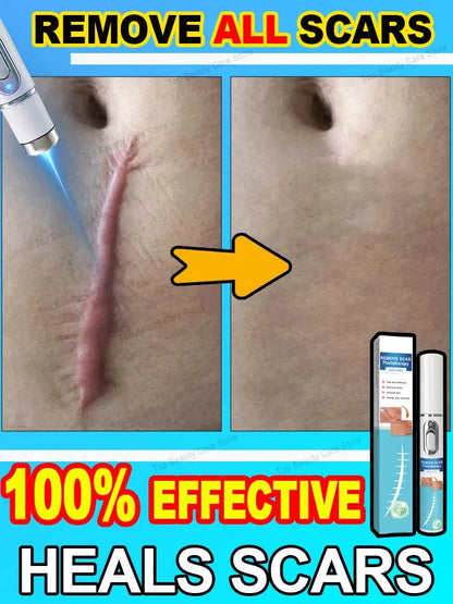 Wound scar laser products